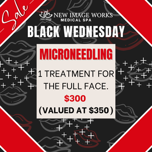 Microneedling - Black Wednesday Special