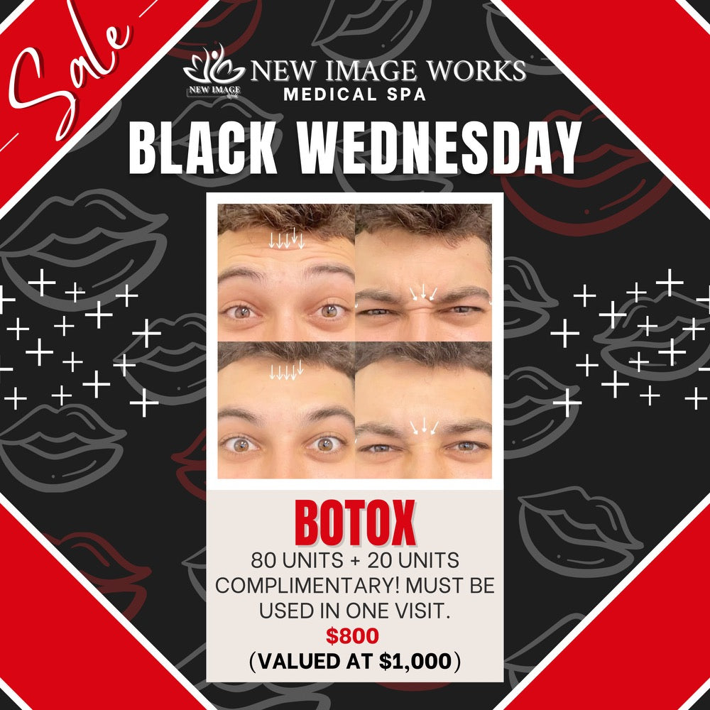 80 Units of Botox + 20 Units Free! Black Wednesday Special