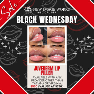 Juvederm Lip Filler ("Wanted Lips") - Black Wednesday Special