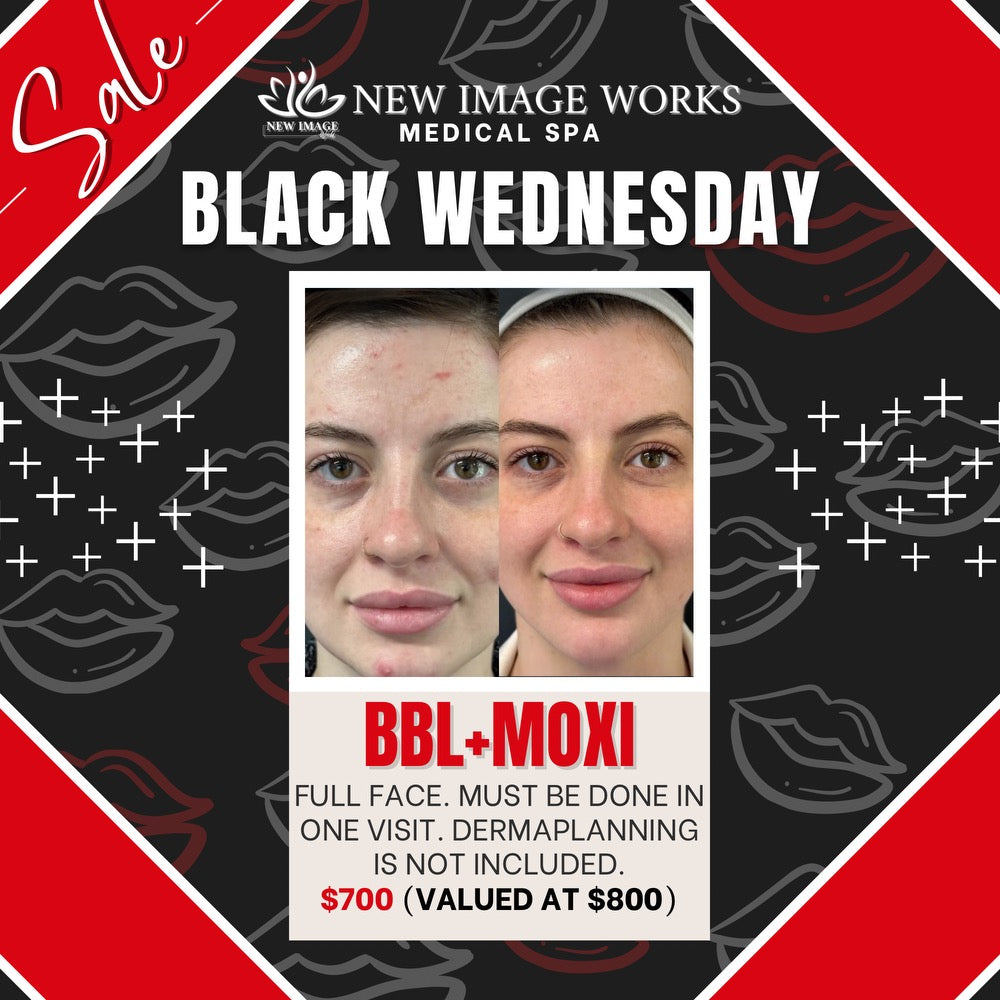 BBL+Moxi Face - Black Wednesday Special