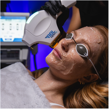 Load image into Gallery viewer, BBL HEROic Face; 1 Treatment - Back to School 2025 Promo
