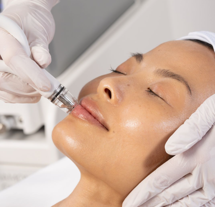 Diamond Glow, 1 Treatment - Summer 2025 MIAMI Special