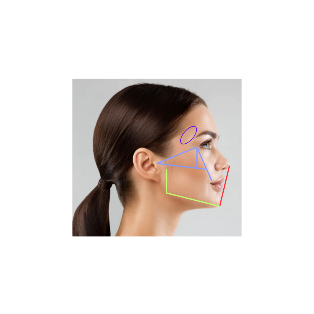 Filler Facial Balancing MODEL May 19, 2022 - MIAMI