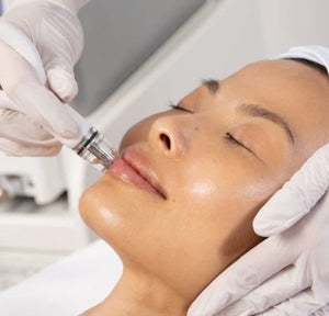 Diamond Glow, 1 Treatment - Summer 2025 MIAMI Special