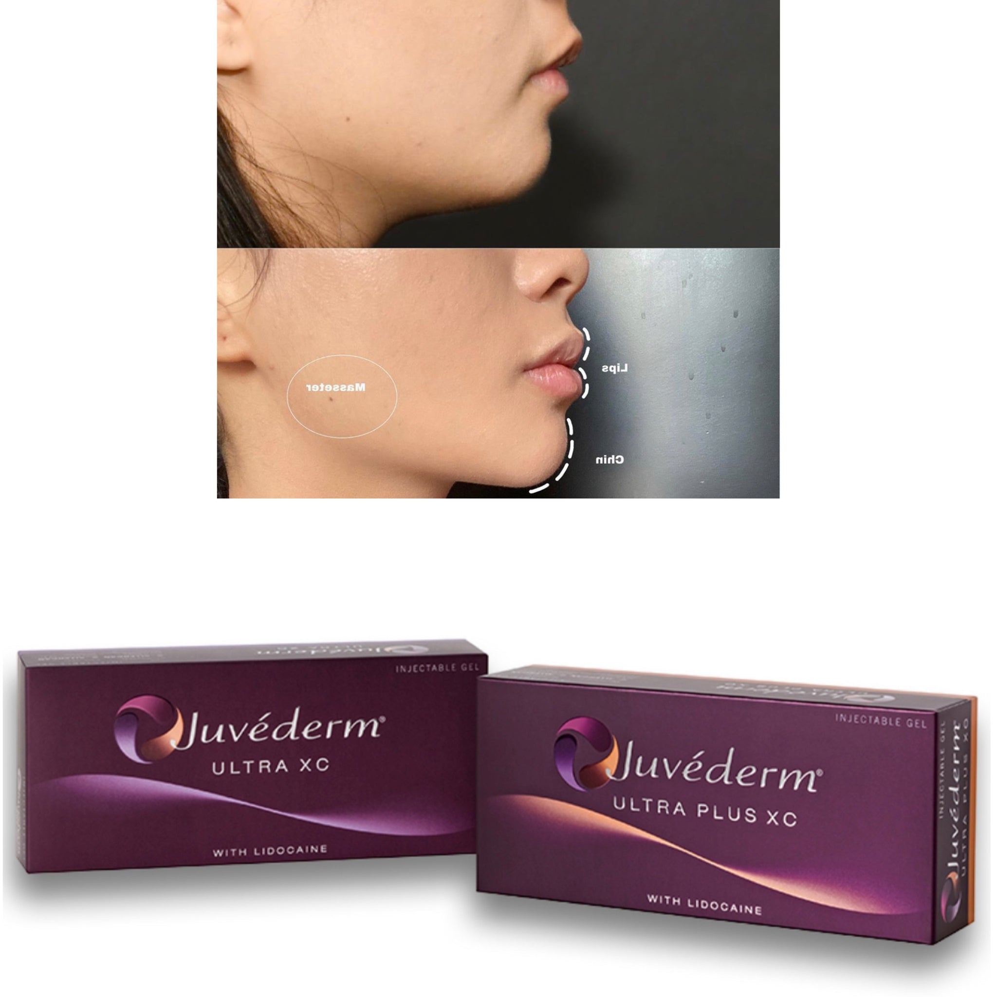 2 Juvederm Syringes New Image Works