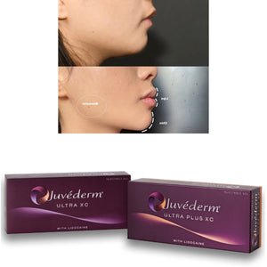 2 Juvederm Syringes + Free DiamondGlow! May Special - Select Locations